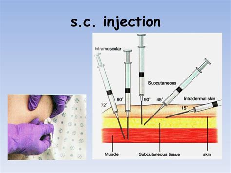 Ppt Administering Medication Sc Id Injections Powerpoint Presentation Id590584