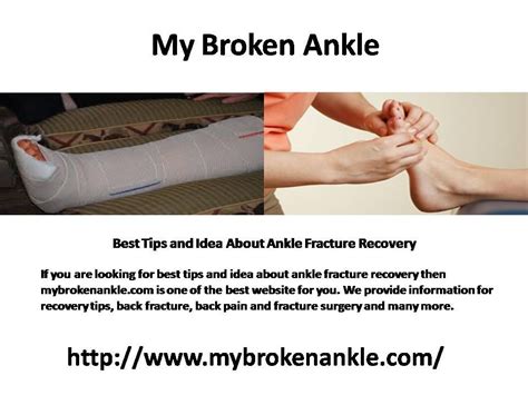 Broken Ankle Recovery Tips 2021