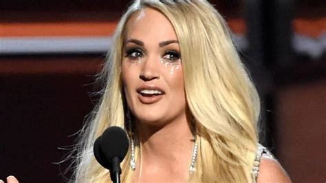 Carrie Underwood Reveals Her Facial Scar From 2017 Accident