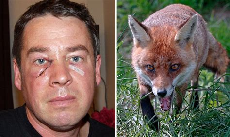 Angler Scarred For Life After Fox Attack In Tent Daily Mail Online