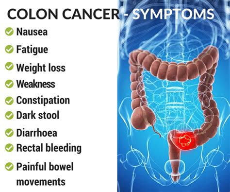 Colon Cancer Causes Diagnosis And Treatment