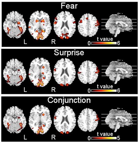 The Neural Circuits Underlying Fear And Surprise Nhsjs