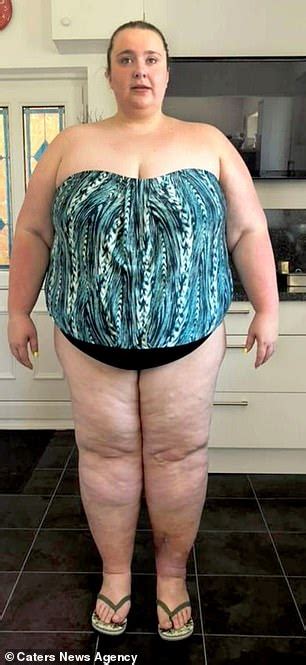 Woman Left With 15lbs Of Saggy Skin After Losing 12st Hopes To Raise