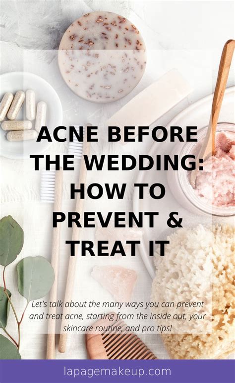 Acne Before The Wedding How To Prevent And Treat It Beauty Tips For