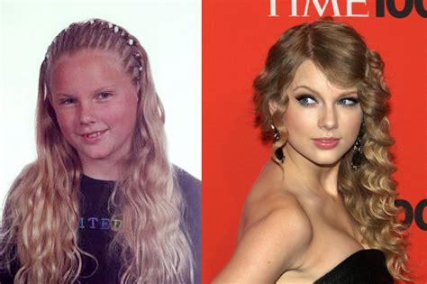 Did Taylor Swift Get Plastic Surgery Before After Pho