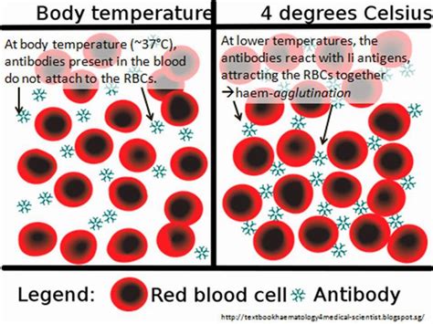 Haematology In A Nutshell Cold Agglutination