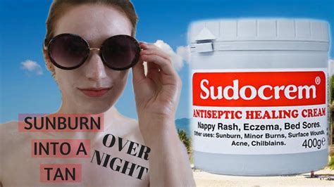 The Sudocrem Experiment How To Get Rid Of Sunburn Fast Also