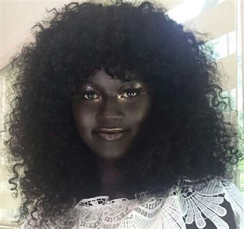 A Gorgeous Young Woman Once Bullied For Her Dark Skin Is