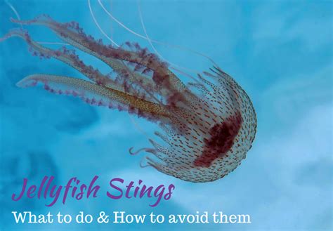 Jellyfish Stingers