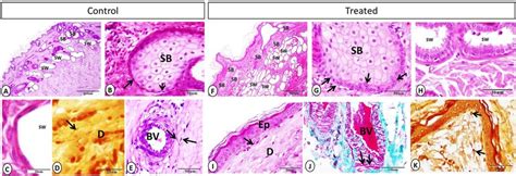 Sebaceous Gland Sweat Gland Telocytes And Dendritic Cells On Control