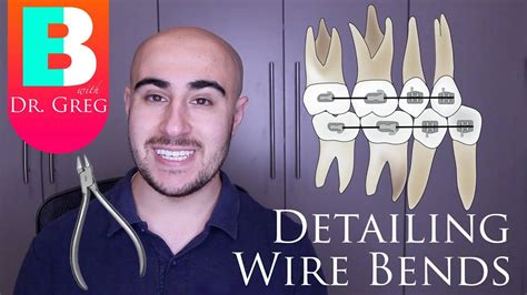 [braces Explained] Detailing Wire Bends Youtube