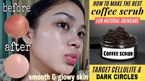 How I Cleared My Skin Diy Coffee Exfoliating Scrub 🍃 It S Ph Youtube