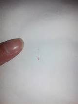 Bed Bug Control Wiki Images