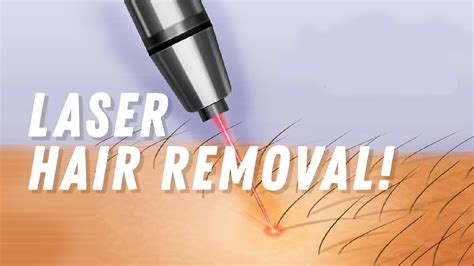 Does Laser Hair Removal Work On Black Skin Expert Advice From A Hair
