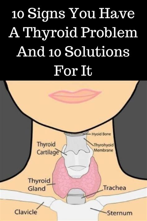 10 Signs You Have A Thyroid Problem And 10 Solutions For It Thyroid