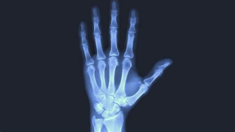 The Science Behind X Rays Explained