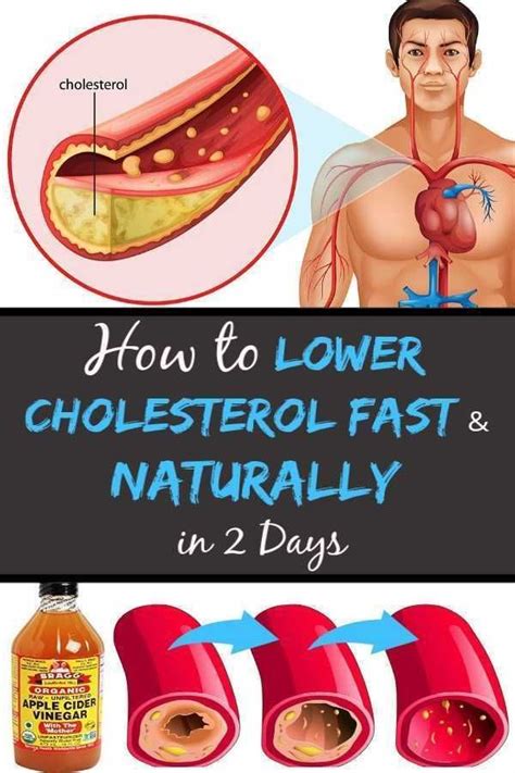 How To Lower Cholesterol Fast And Naturally In 2 Days 10 Home Remedies