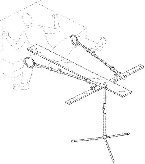 Figure 2 From The Utilization Of Pediatric Hip Spica Tables Among Orthopedic Surgeons Locally