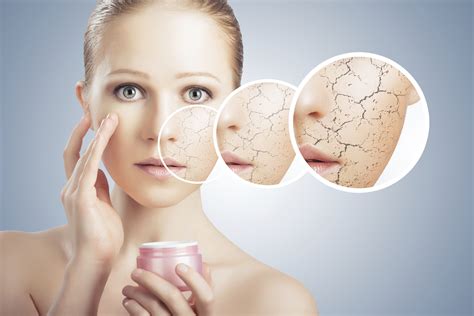 Mypurewellness What Do You Know About Dry Skin
