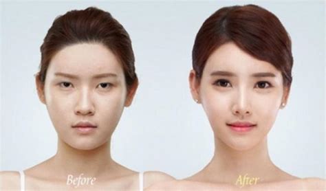 81 Photos Of Plastic Surgery In Korea That Will Make Your Jaw Drop