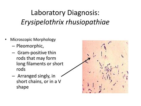 Ppt Gram Positive Bacilli Part Two Powerpoint Presentation Free