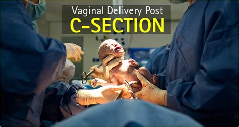 Can Women Choose A Vaginal Birth After C Section