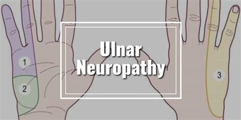Ulnar Neuropathy Legacy Spine And Neurological Specialists