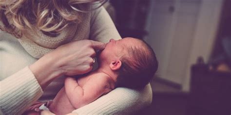 Mengenal Sindrom Moebius Dan Gejalanya Gangguan Saraf Langka Pada Bayi