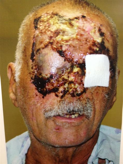 His family watched body camera it's one of those videos like george floyd and even ahmaud arbery where it's just so graphic. merritt told troopers used abusive language during. Ronald Poppo Picture (Warning: Extremely Graphic) - CBS Miami