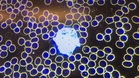 Borrelien sind für den menschen vor allem dann gefährlich, wenn sie lange unerkannt und unbehandelt werden. Borreliose im Dunkelfeld | Dr. Retzek's Recherchen - YouTube