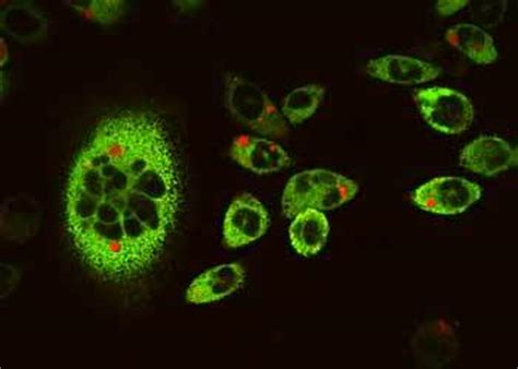 Chinese Hamster Ovary Cells Specimen Nikons Microscopyu