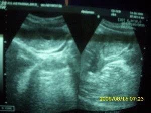 Bukannya tampak menggemaskan, 8 penampakan janin bayi hasil usg ini justru tampak menyeramkan. Foto Usg Kelamin Janin Perempuan - foto cewek cantik