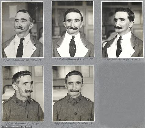 Images Show How Soldiers Seriously Injured In Wwi Had Faces Transformed