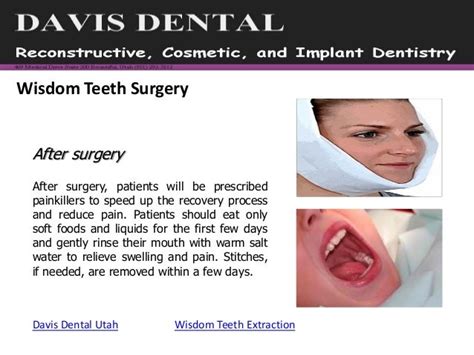 How To Reduce Wisdom Teeth Swelling Before Surgery How To Reduce