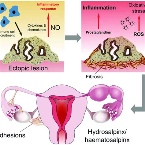 Histological Architecture Of The Endometrium Fallopian Tubes Ft And