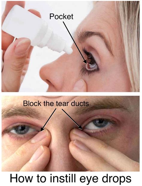 When you see your ophthalmologist for eye pain relief, they can find and treat the actual cause of your pain and possibly save your sight. How to Use Eye Drops - Glaucoma Associates of Texas