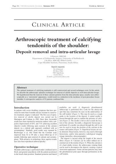 Arthroscopic Treatment Of Calcifying Tendonitis Of The Shoulder