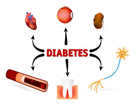 Complexities of Diabetes Treatment: Type 1, Type 2 and the New PCSK9 ...
