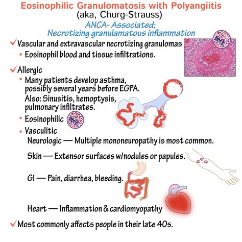Pathology Glossary Eosinophilic Granulomatosis With Polyangiitis Aka