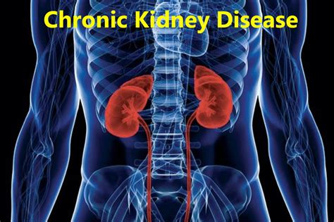 What Is Chronic Kidney Disease The Mirror Hear And Be Heard