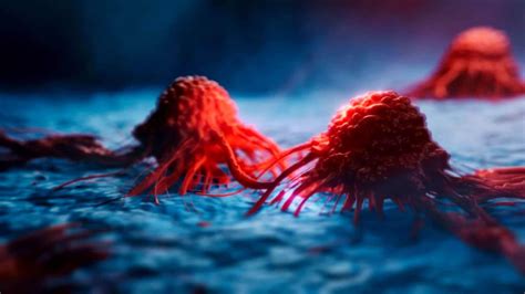 New Technique Starves Energy From Deadly Cancer Tumors Destroying Them