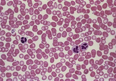 Lm Of Human Red Blood Cells And Neutrophils Stock Image P2420107