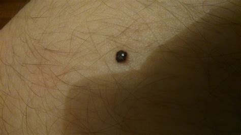 MON GRAIN DE BEAUTÉ MINQUIÈTE