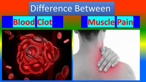 Difference Between Blood Clot And Muscle Pain Youtube