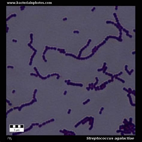 Streptococcus Agalactiae Under Microscope Group B Streptococcus Or Gbs