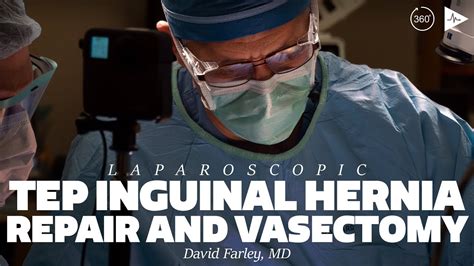 Laparoscopic Tep Inguinal Hernia Repair And Vasectomy 360 By David R