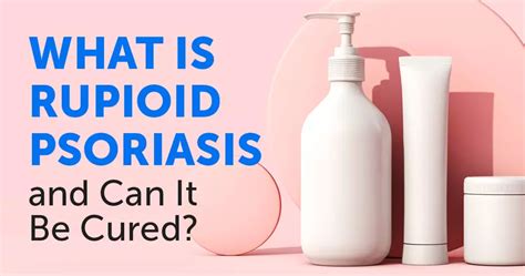 What Is Rupioid Psoriasis And Can It Be Cured Mypsoriasisteam