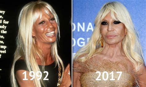 Donatella Versace Before And After Young Donatellas Style Compared To