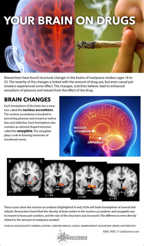 How Pot Smoking Changes Your Brain Infographic Brain Scan Brain