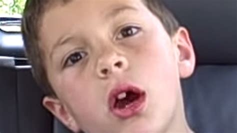 See Viral Star Of David After Dentist Now 7 Years Later
